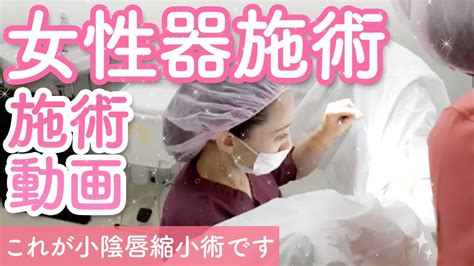 まんこ 整形|女性器形成（小陰唇縮小）の美容整形 